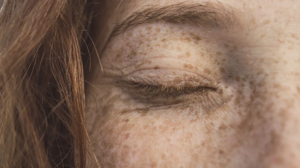 Close-up of the eye area with freckles and fine lines.