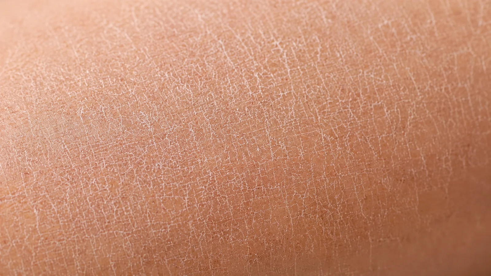 Close-up of skin with small cracks.