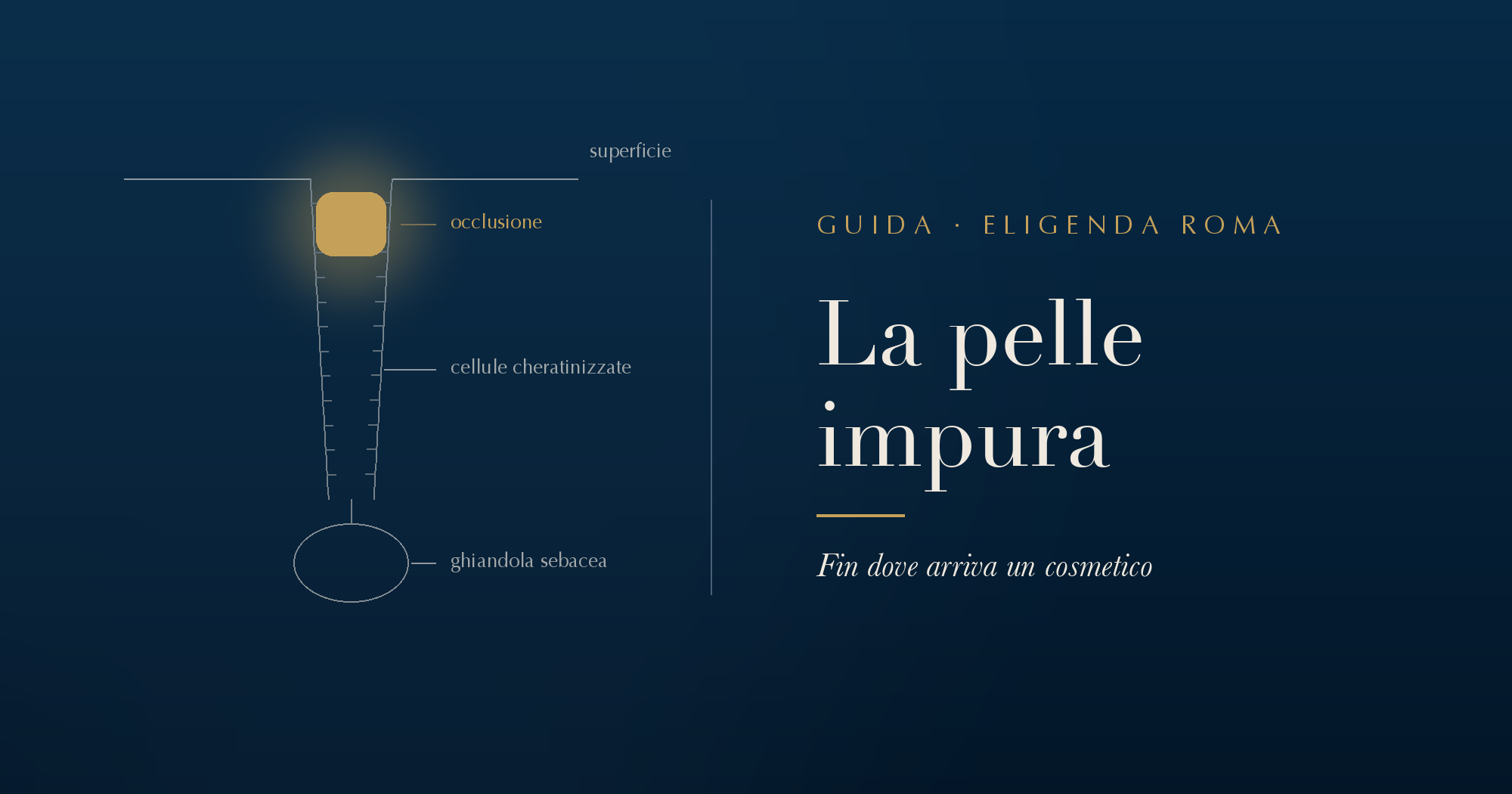 Sezione di un follicolo occluso: la ghiandola sebacea in fondo, le cellule cheratinizzate lungo le pareti e in alto, appena sotto la superficie della pelle, l'occlusione evidenziata in oro
